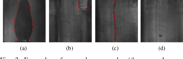 Figure 3 for Reconstruction-Based Anomaly Localization via Knowledge-Informed Self-Training