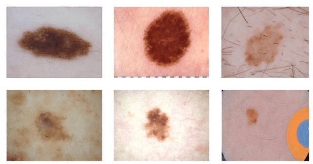 Figure 3 for Multi-Scale Transformer Architecture for Accurate Medical Image Classification