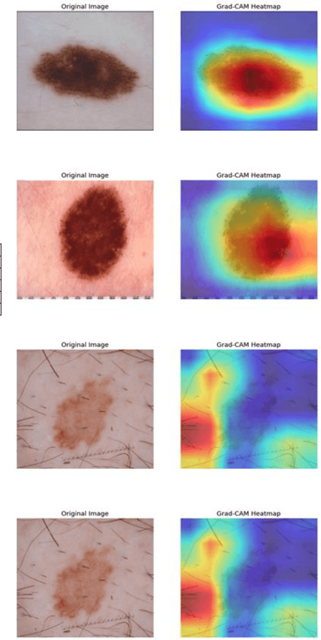 Figure 4 for Multi-Scale Transformer Architecture for Accurate Medical Image Classification