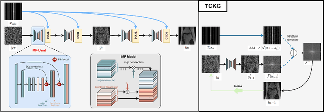 Figure 1 for TC-DiffRecon: Texture coordination MRI reconstruction method based on diffusion model and modified MF-UNet method