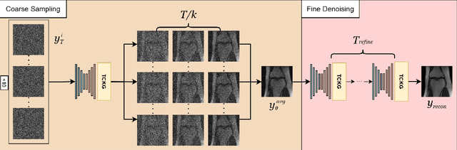 Figure 3 for TC-DiffRecon: Texture coordination MRI reconstruction method based on diffusion model and modified MF-UNet method