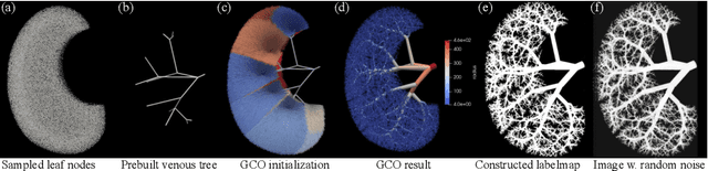 Figure 1 for Extremely weakly-supervised blood vessel segmentation with physiologically based synthesis and domain adaptation