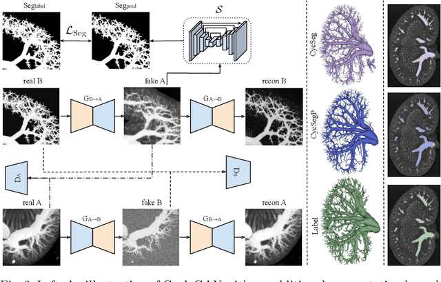 Figure 3 for Extremely weakly-supervised blood vessel segmentation with physiologically based synthesis and domain adaptation