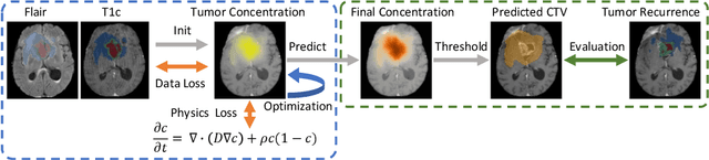 Figure 1 for Spatial Brain Tumor Concentration Estimation for Individualized Radiotherapy Planning