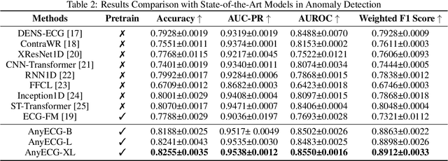 Figure 3 for AnyECG: Foundational Models for Electrocardiogram Analysis