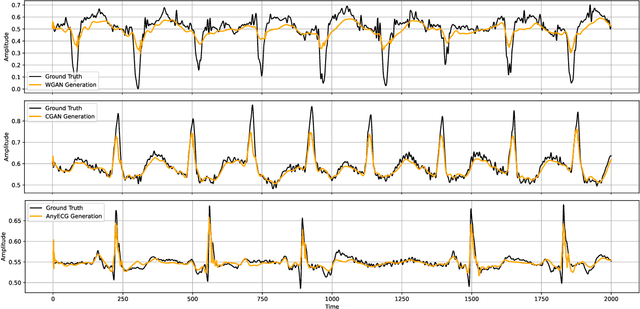 Figure 4 for AnyECG: Foundational Models for Electrocardiogram Analysis