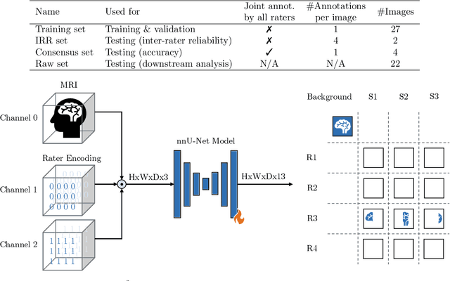 Figure 2 for MLV$^2$-Net: Rater-Based Majority-Label Voting for Consistent Meningeal Lymphatic Vessel Segmentation