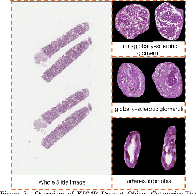 Figure 3 for PySpatial: A High-Speed Whole Slide Image Pathomics Toolkit