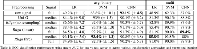 Figure 2 for The Rlign Algorithm for Enhanced Electrocardiogram Analysis through R-Peak Alignment for Explainable Classification and Clustering