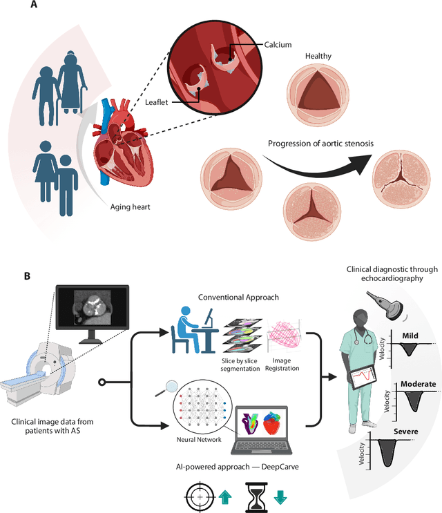 Figure 1 for AI-powered multimodal modeling of personalized hemodynamics in aortic stenosis