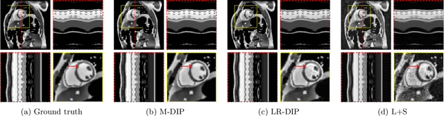 Figure 4 for Motion-Guided Deep Image Prior for Cardiac MRI