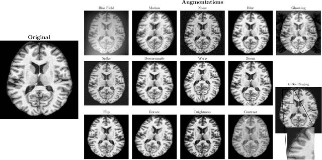 Figure 4 for deepmriprep: Voxel-based Morphometry (VBM) Preprocessing via Deep Neural Networks