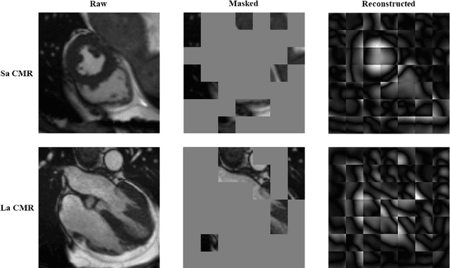 Figure 4 for Large-scale cross-modality pretrained model enhances cardiovascular state estimation and cardiomyopathy detection from electrocardiograms: An AI system development and multi-center validation study