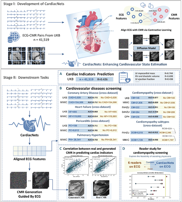 Figure 1 for Large-scale cross-modality pretrained model enhances cardiovascular state estimation and cardiomyopathy detection from electrocardiograms: An AI system development and multi-center validation study