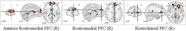 Figure 3 for BI AVAN: Brain inspired Adversarial Visual Attention Network