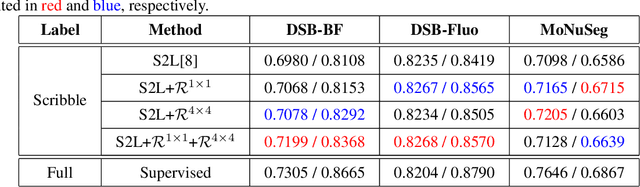 Figure 2 for Scribble-supervised Cell Segmentation Using Multiscale Contrastive Regularization