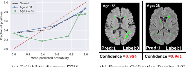 Figure 1 for Mitigating Calibration Bias Without Fixed Attribute Grouping for Improved Fairness in Medical Imaging Analysis