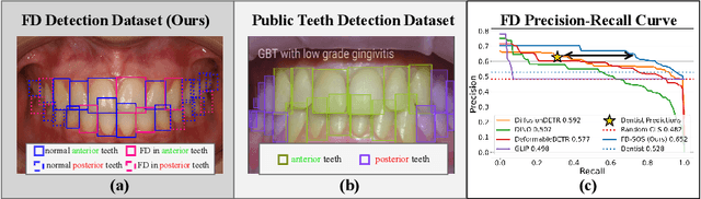 Figure 1 for FD-SOS: Vision-Language Open-Set Detectors for Bone Fenestration and Dehiscence Detection from Intraoral Images