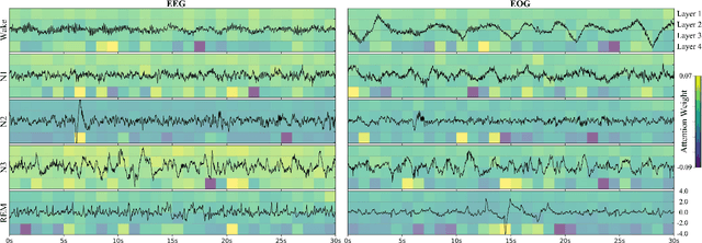 Figure 2 for SleepDIFFormer: Sleep Stage Classification via Multivariate Differential Transformer