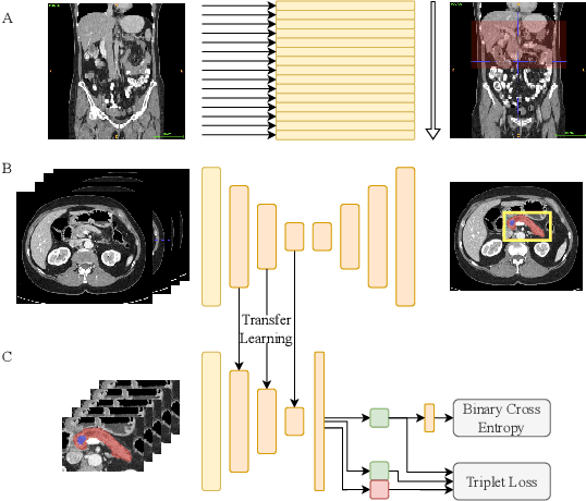 Figure 1 for Exploiting segmentation labels and representation learning to forecast therapy response of PDAC patients