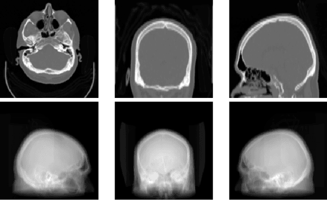 Figure 3 for GaSpCT: Gaussian Splatting for Novel CT Projection View Synthesis