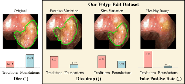 Figure 1 for Polyp-E: Benchmarking the Robustness of Deep Segmentation Models via Polyp Editing