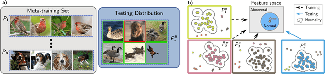 Figure 1 for Zero-Shot Anomaly Detection without Foundation Models