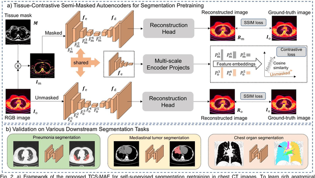 Figure 2 for Tissue-Contrastive Semi-Masked Autoencoders for Segmentation Pretraining on Chest CT