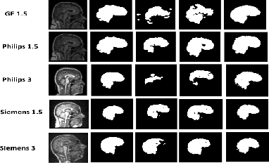 Figure 4 for ConvLoRA and AdaBN based Domain Adaptation via Self-Training