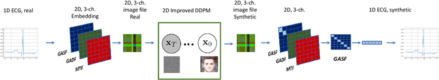 Figure 1 for Synthetic ECG Signal Generation using Probabilistic Diffusion Models