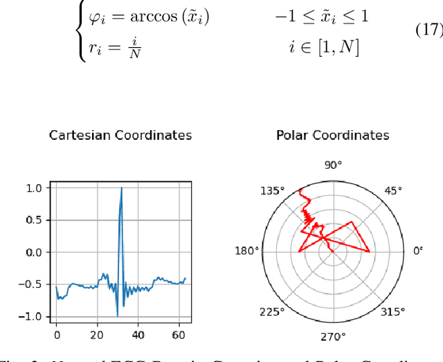 Figure 2 for Synthetic ECG Signal Generation using Probabilistic Diffusion Models