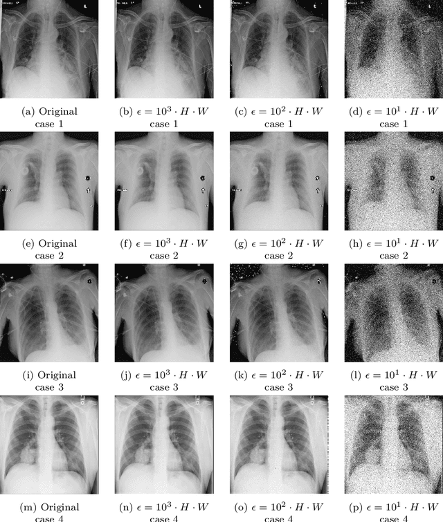 Figure 2 for Local Differential Privacy Image Generation Using Flow-based Deep Generative Models