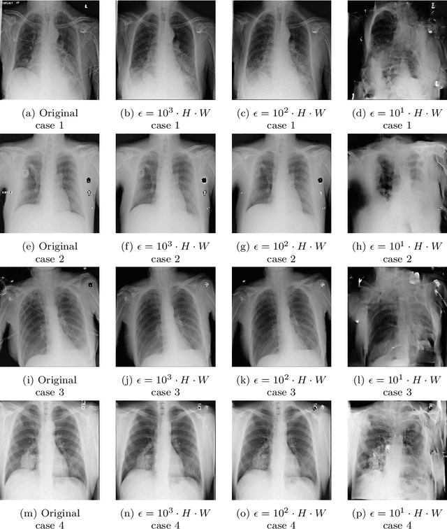 Figure 4 for Local Differential Privacy Image Generation Using Flow-based Deep Generative Models