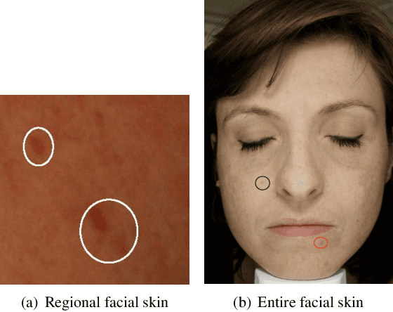 Figure 4 for Comparison of Methods in Human Skin Decomposition