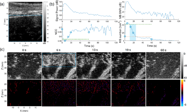 Figure 1 for Optimizing In Vivo Data Acquisition for Robust Clinical Microvascular Imaging Using Ultrasound Localization Microscopy