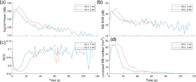 Figure 3 for Optimizing In Vivo Data Acquisition for Robust Clinical Microvascular Imaging Using Ultrasound Localization Microscopy