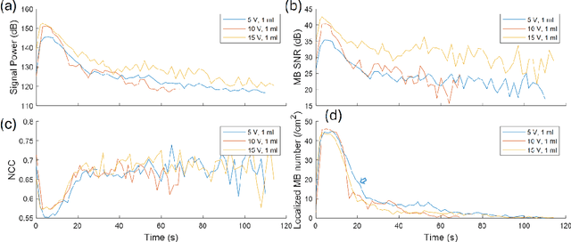 Figure 4 for Optimizing In Vivo Data Acquisition for Robust Clinical Microvascular Imaging Using Ultrasound Localization Microscopy
