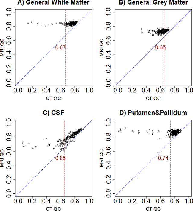 Figure 3 for Deep learning-based brain segmentation model performance validation with clinical radiotherapy CT