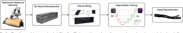 Figure 2 for Reslicing Ultrasound Images for Data Augmentation and Vessel Reconstruction