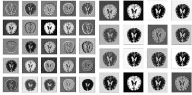 Figure 1 for Enhancing Alzheimer's Disease Prediction: A Novel Approach to Leveraging GAN-Augmented Data for Improved CNN Model Accuracy