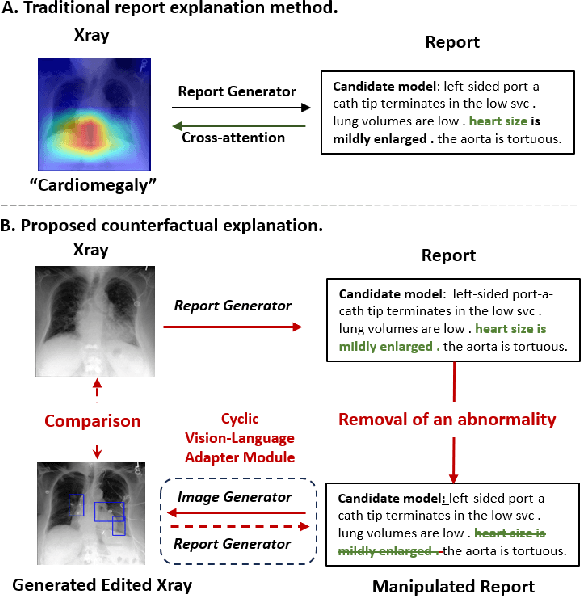 Figure 1 for Decoding Report Generators: A Cyclic Vision-Language Adapter for Counterfactual Explanations