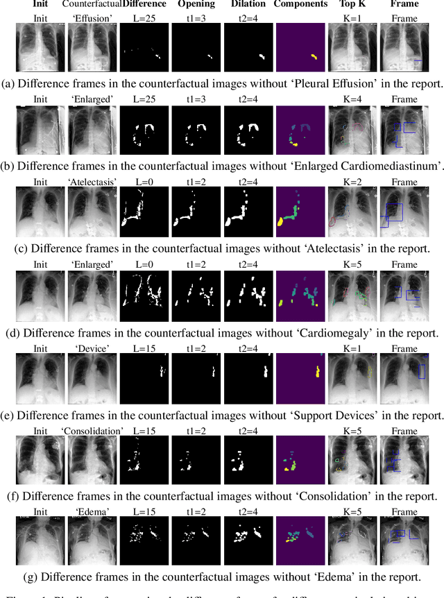 Figure 3 for Decoding Report Generators: A Cyclic Vision-Language Adapter for Counterfactual Explanations