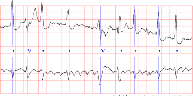 Figure 3 for Harnessing FPGA Technology for Enhanced Biomedical Computation