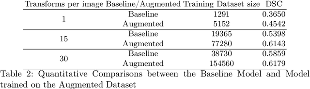 Figure 3 for AutoPET Challenge: Tumour Synthesis for Data Augmentation