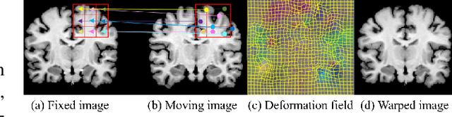 Figure 1 for ModeTv2: GPU-accelerated Motion Decomposition Transformer for Pairwise Optimization in Medical Image Registration