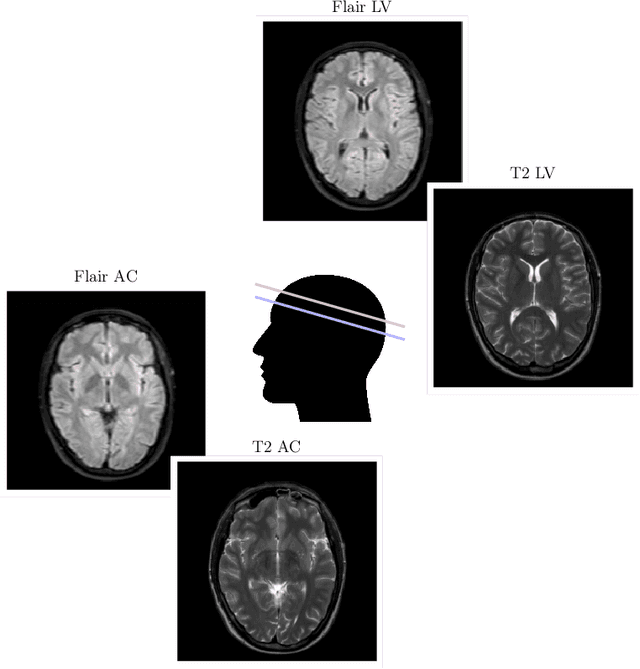 Figure 2 for A Brain Age Residual Biomarker (BARB): Leveraging MRI-Based Models to Detect Latent Health Conditions in U.S. Veterans