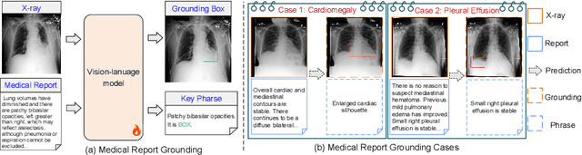 Figure 1 for MedRG: Medical Report Grounding with Multi-modal Large Language Model