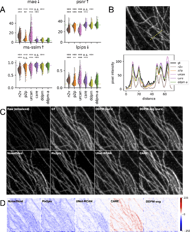 Figure 2 for Denoising diffusion models for high-resolution microscopy image restoration