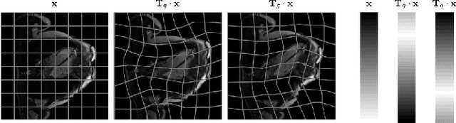 Figure 3 for Fully Unsupervised Dynamic MRI Reconstruction via Diffeo-Temporal Equivariance