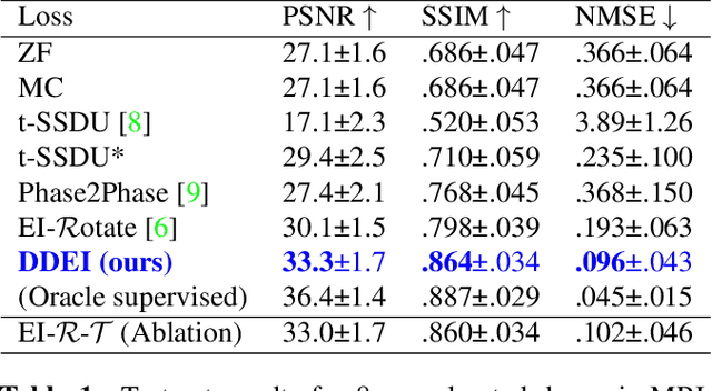 Figure 2 for Fully Unsupervised Dynamic MRI Reconstruction via Diffeo-Temporal Equivariance